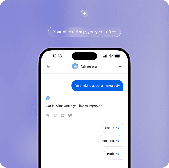 Aurora AI concierge chat preview